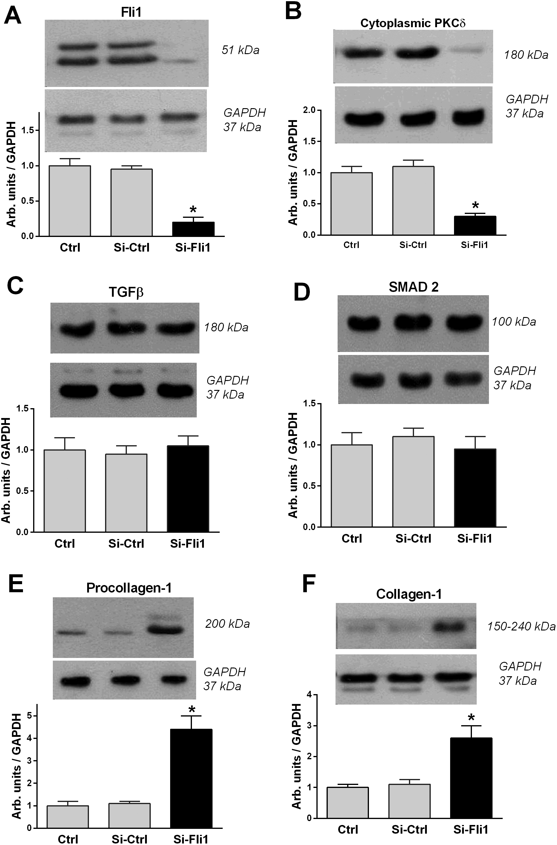 Figure 3. Effect of Fli1 silencing on protein levels in human umbilical arteries